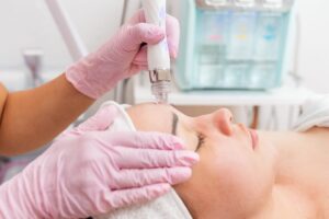 aquafacial hydrafacial großbottwar heilbronn ludwigsburg stuttgart gesichtsreinigung akne