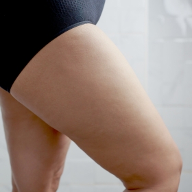 peeling oberschenkel cellulite